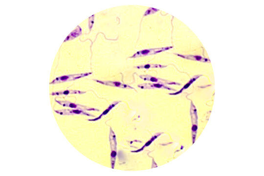 Promastigote of lishmania spp under microscope.