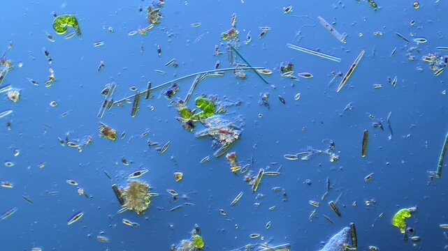 Microorganism Amoeba under the microscope at 100x Magnification