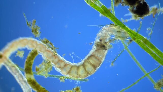 Worms under the microscope