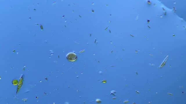 Single-celled ciliates and other microorganisms under the microscope at 100x Magnification
