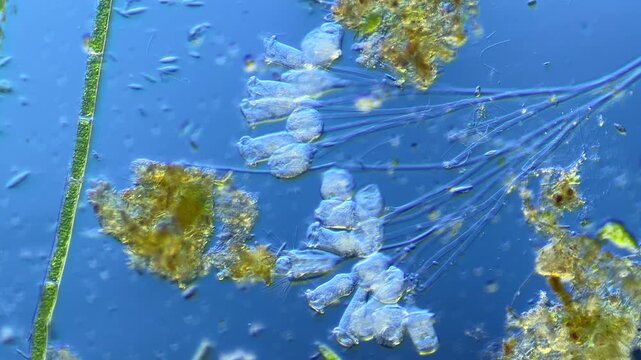 Single-celled ciliates and other microorganisms under the microscope at 100x Magnification