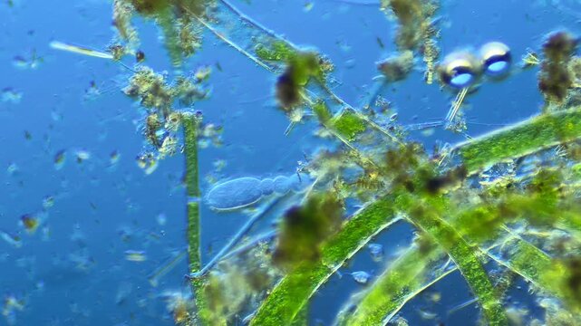 Single-celled ciliates and other microorganisms under the microscope at 100x Magnification