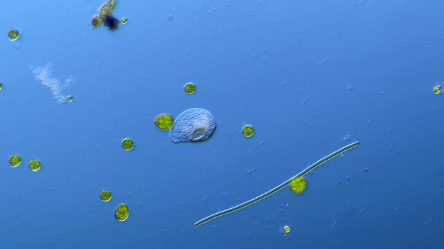 Single-celled ciliates and other microorganisms under the microscope at 100x Magnification