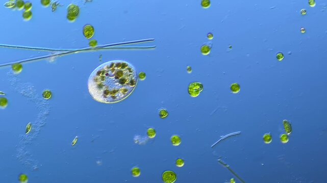 Single-celled ciliates and other microorganisms under the microscope at 100x Magnification