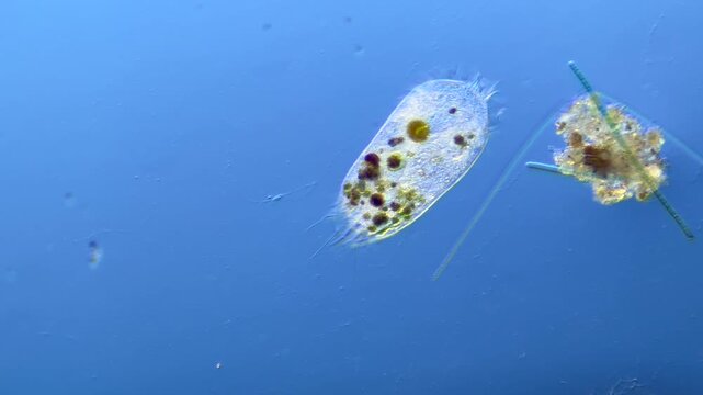 Protists Ciliates  under the microscope at 100x Magnification