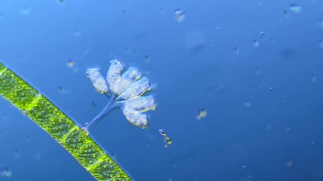 Protists Ciliates  under the microscope at 100x Magnification