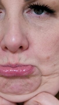 Mature woman touching her chin showing excess fat and contemplating submental liposuction neck liposuction procedure for a refined jawline silhouette
