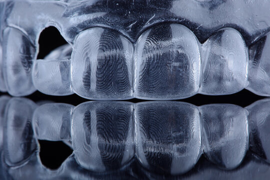 Printed transparent dental cap made of polymer on a light colorful background. Dental splint against bruxism.