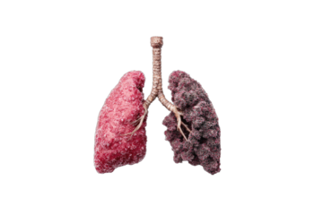 A split image shows healthy pink lungs on the left and diseased dark lungs on the right