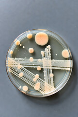 Petri Dish with Bacterial Colonies  in Microbiology Lab