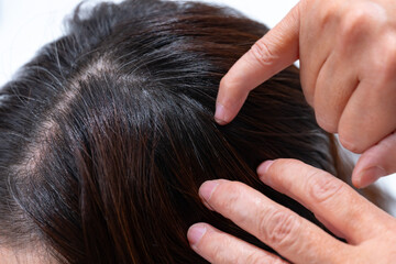 髪　女性　クローズアップ