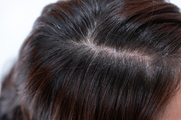 髪　女性　クローズアップ