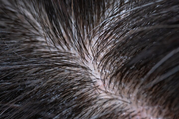 髪　女性　クローズアップ