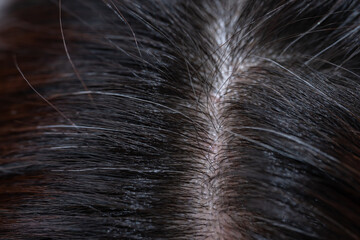 髪　女性　クローズアップ