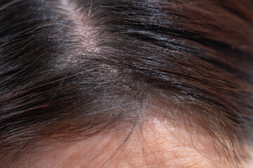 髪　女性　クローズアップ