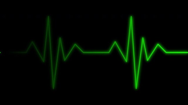 Glowing neon green color hearbeat pulse line animation. 4k animated video with alpha channel
