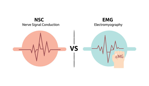 Medical illustration comparing two neurological diagnostic tests: Nerve Signal Conduction (NSC) and Electromyography (EMG).