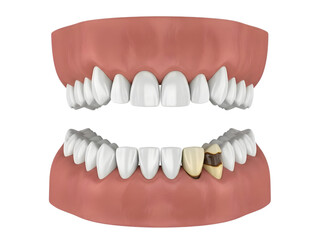 Obraz premium teeth and dental tools