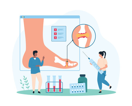 Diagnosis and treatment of gout, inflammatory arthritis of foot joints, rheumatology. Tiny people study infographic medical chart of ankle, watch out for uric acid crystals cartoon vector illustration