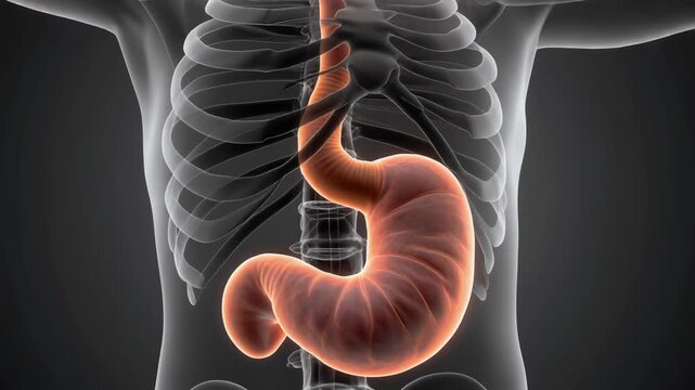 3D Animation of Human Tracheoesophageal Fistula Anatomy