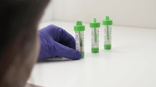 Medical professional in blue gloves handling a feces sample test tube isolated on a white background