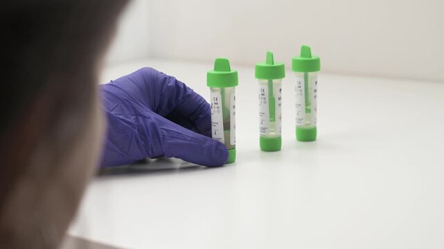 Medical professional taking a stool sample kit from a white table in a laboratory