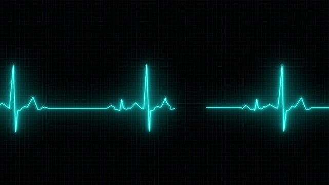 Abstract neon heartbeat signal icon animation on a grid background. Glowing neon  cyan color heartbeat rate Animation. Emergency ECG monitoring. loop motion animate 4k footage. Abstract heartbeat