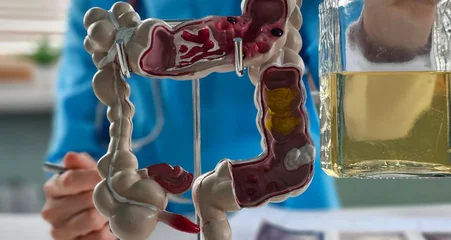 Fototapete Bar Doctor holds a model of the digestive system and a bottle of alcohol  © Nadzeya
