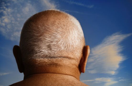 Back view of balding head with gray hair against blue summer sky