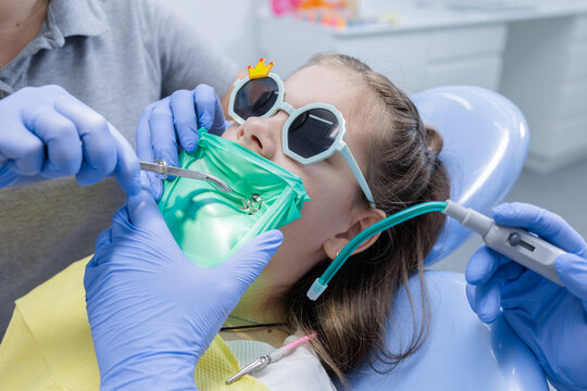 Fear free pediatric dental procedure with rubber dam isolation and protective eyewear