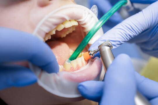 Child teeth cleaning with polishing brush during modern pediatric dental checkup
