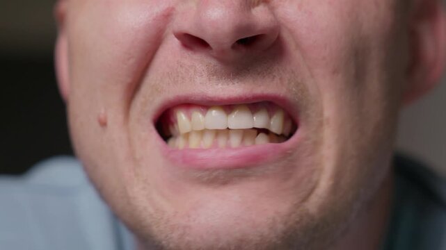 Close up of a man grinding his teeth with visible jaw tension. Focus on teeth and lips without full face, capturing a natural mouth movement and human facial behavior detail.High quality 4k footage