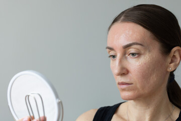 Woman looking at mirror on her face just after painful beauty injections.