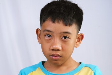 Close up portrait of an Asian boy with visible eye irritation, isolated on a white background, suitable for health awareness