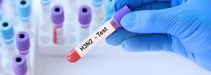 Fototapeta premium Doctor holding blood sample tube labeled ?3N2 influenza a virus test, laboratory diagnostics concept highlighting seasonal epidemic risk, vaccination importance and early antiviral treatment