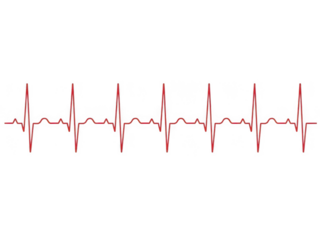 Ecg waveform isolated on transparent background