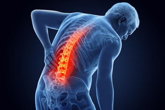 Back pain illustration in X-ray 