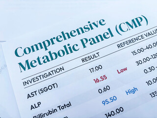 Comprehensive metabolic panel report top view showing on the paper, backdrop.