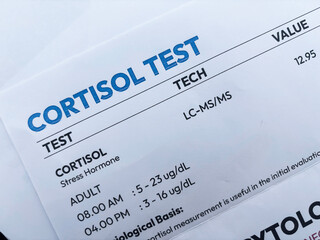 Cortisol Test report with data and details top view health concept backdrop.