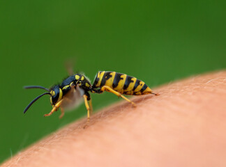 photo close-up of a striped dangerous insect wasp painfully injects a sting and venom into human skin