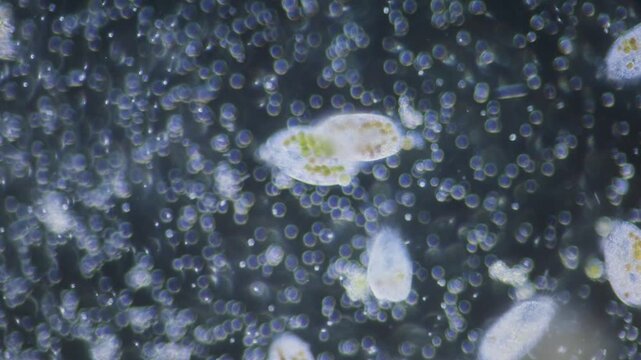 Single-celled paramecium with symbiotic alga inside