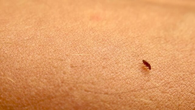 Macro Flea walking on human skin searching for a blood feeding site, showing parasitic behavior, skin health risks and disease transmission. For medical education and healthcare awareness. Parasites.