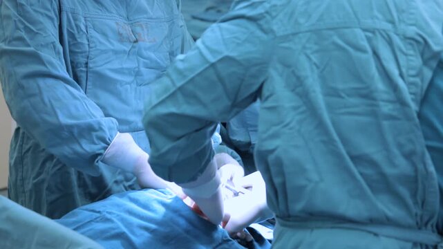 Team of surgeons performing a C-section surgery in operating room, tilt-up
