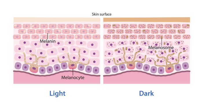 The mechanism of skin pigmentation vector illustration on white background. Comparison of light and dark skin tones are produced by melanocytes in the epidermal layer. Skin care and anatomy concept.