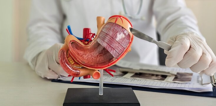 Surgeon held scalpel over an anatomical model of human stomach. Photosurgical treatment of stomach diseases and procedures