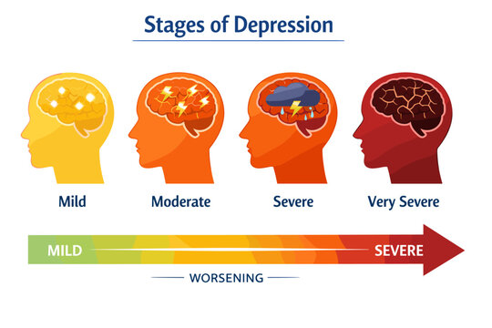 Stages of depression: visual representation from mild to very severe