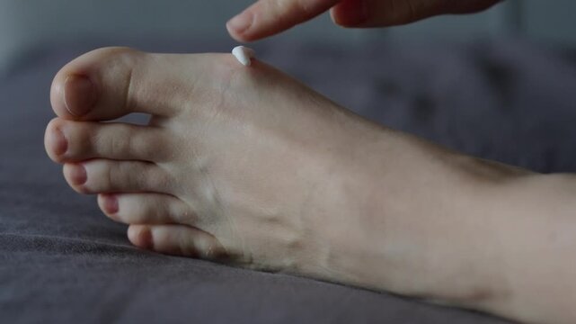 Close up of bare foot while a hand points to painful big toe joint. Concept of bunion, gout, arthritis and foot joint pain
