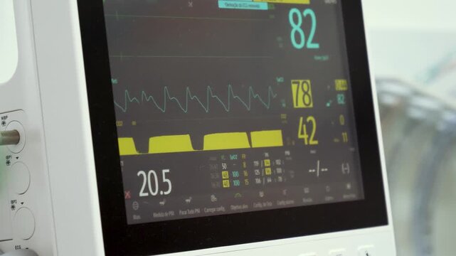 Anesthesia Machine Monitor Measuring Parameters During Surgery. Close up