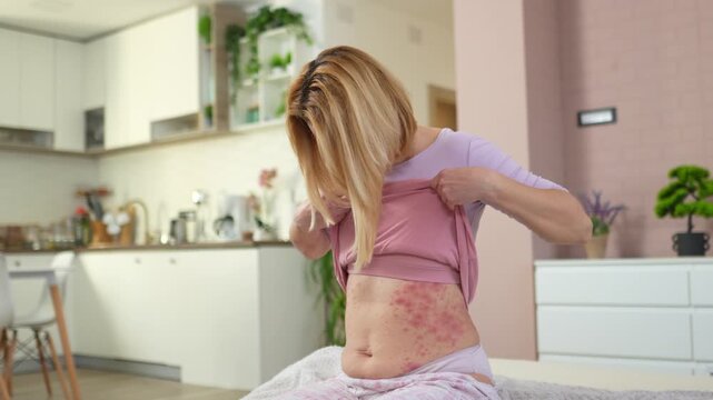 Woman with skin allergy showing an itchy red rash