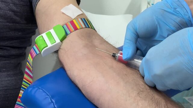 Gloved hands of a nurse input a needle into patient's vein. Taking blood test from a patient. High quality 4k 